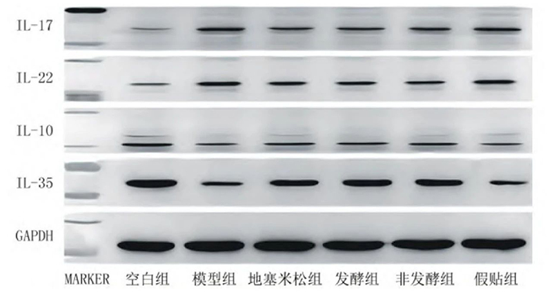 空白組和支氣管哮喘各組大鼠肺組織中IL－17、IL－22、IL－10、IL－35蛋白表達(dá)電泳圖